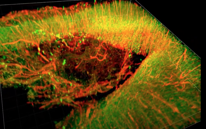研究人员利用一种“脑胶”材料实现神经元创伤后再生