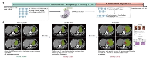 为了消灭癌症 他们把几千份遗憾喂给代码