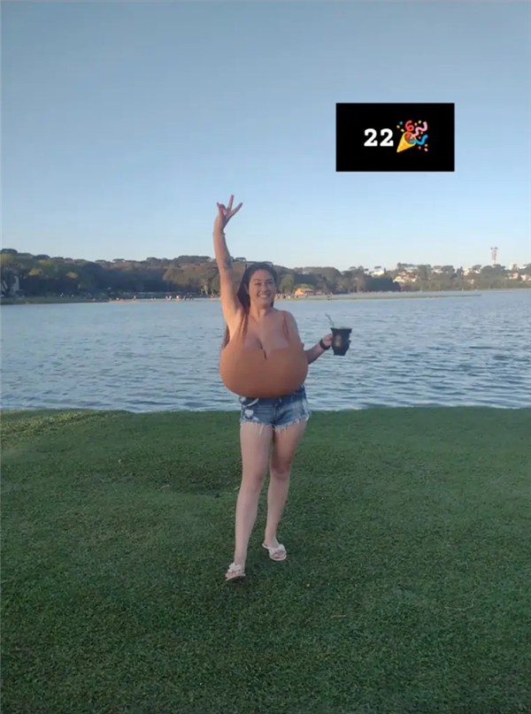 巴西女子患“巨乳症”失控!短短几月长O杯 出行得坐轮椅