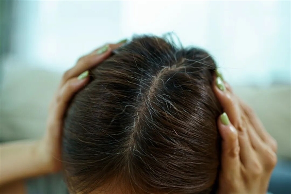 白头发别急着拔！重新变黑发的方法找到了