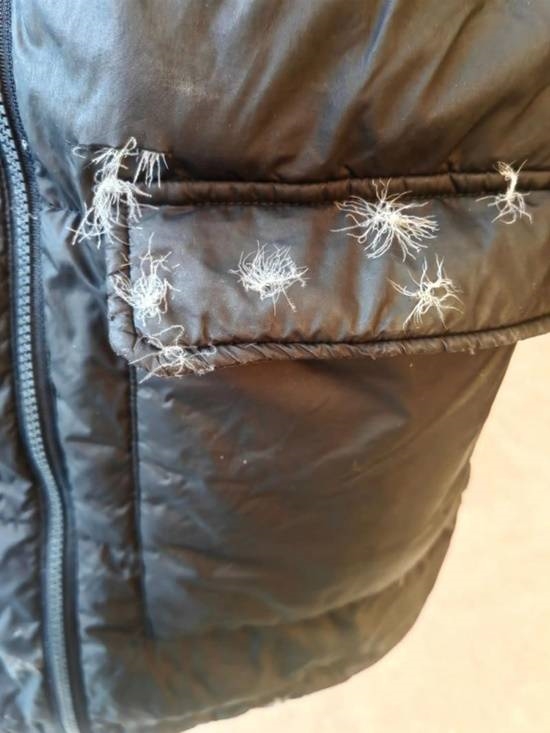 过量吸入微小羽绒蛋白 男子长期穿破损羽绒服确诊“羽绒肺”