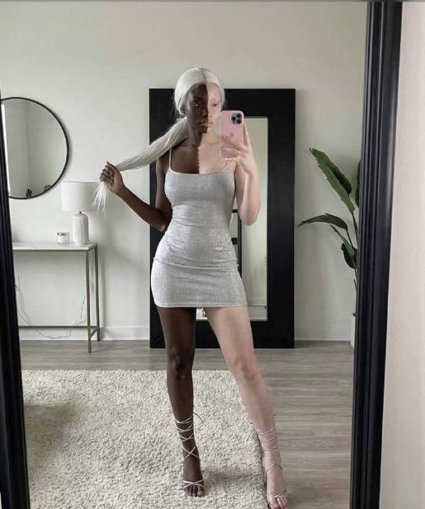 一个患有白癜风的美国女孩火了 网友：还真能这么均匀